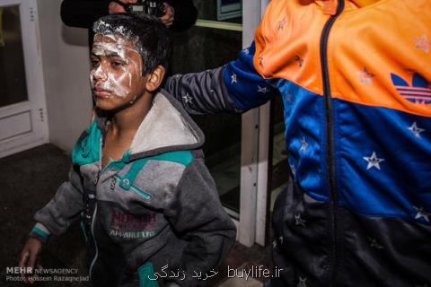 ۷۰ درصد عوارض سوختگی حوادث چهارشنبه سوری ماندگار است
